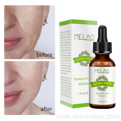 Skin Care Pure Organic Retinol Serum